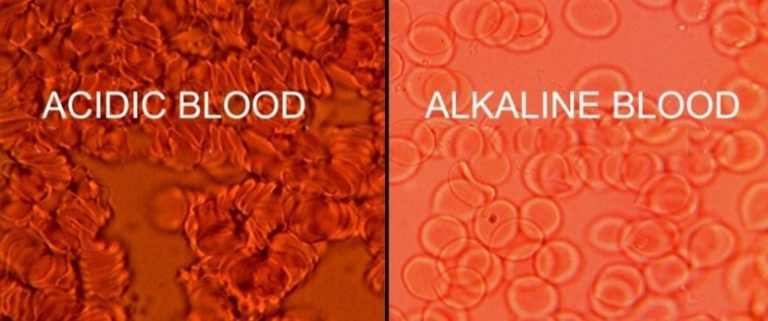 pH Acid Alkaline Blood